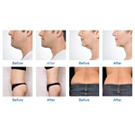 آلة كريو 360 لعام 2022، آلة تكسير الدهون بالتبريد بأسعار أفضل لإنقاص الوزن عن طريق تكسير الدهون بالتبريد