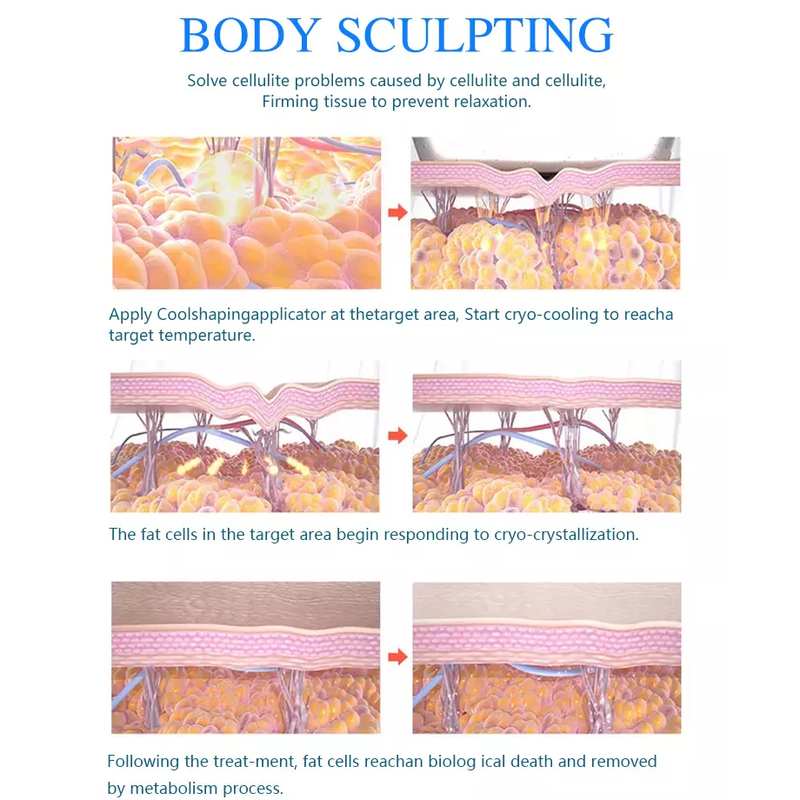 وصول جديد 2022 cryolipolysis محمول 360 جسم تجميد آلة نحت الجسم البارد / آلة cryolipolisis 360