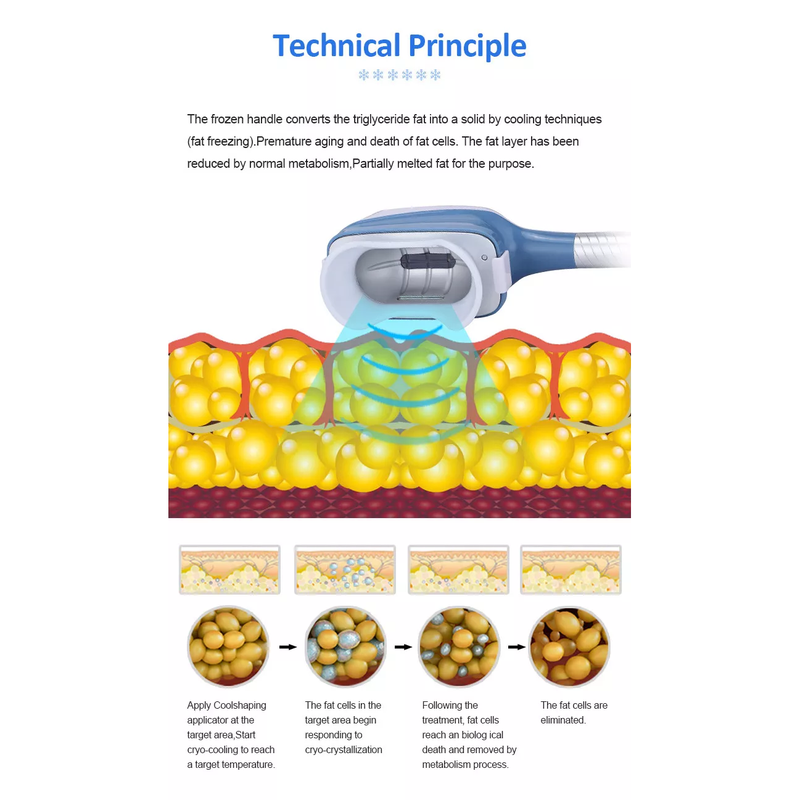 مبيعات المصنع 2022 آلة نحت 360 Cryolipolysis / آلة تجميد الدهون تقنية التبريد تقليل السيلوليت