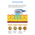 مبيعات المصنع 2022 آلة نحت 360 Cryolipolysis / آلة تجميد الدهون تقنية التبريد تقليل السيلوليت