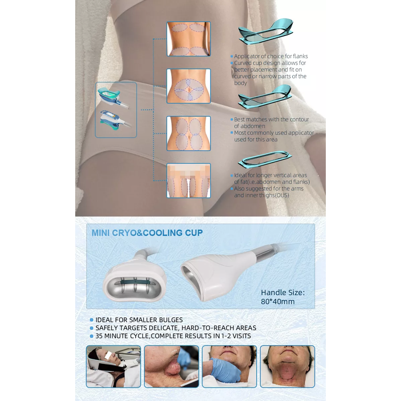 مبيعات المصنع 2022 آلة نحت 360 Cryolipolysis / آلة تجميد الدهون تقنية التبريد تقليل السيلوليت
