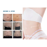 مبيعات المصنع 2022 آلة نحت 360 Cryolipolysis / آلة تجميد الدهون تقنية التبريد تقليل السيلوليت