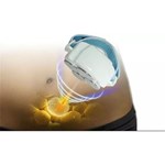 جهاز تجويف 80k لتشكيل الجسم وتنحيف حرق الدهون