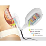 أفضل سعر لآلة نحت الجسم بالتبريد الدهون تجميد