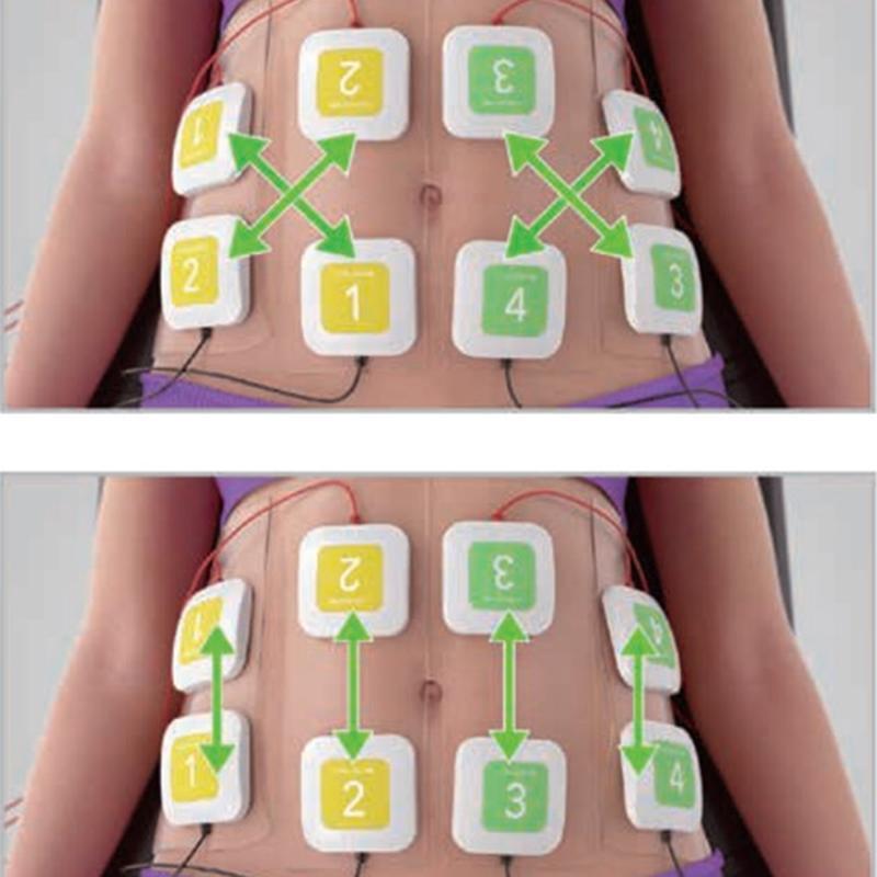 جهاز تشكيل الجسم بتحفيز العضلات كهربائيًا Trusculpt ID + Flex EMS الاحترافي