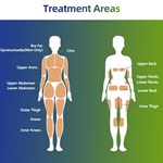 آلة Trushape ID للعلاج بالتحفيز الكهربائي للعضلات ونحت الجسم Emslim