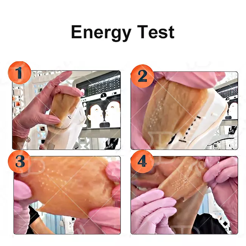 جهاز إعادة تأهيل الجلد بالموجات فوق الصوتية مع دوران 360 درجة لإزالة التجاعيد، جهاز MMFU الرأسي 4D