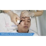 آلة 12D ICE hifu لرفع الوجه وتشد البشرة بجهاز HIFU