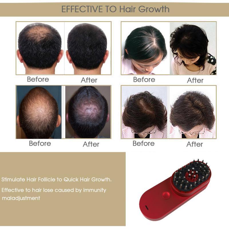 فرشاة شعر كهربائية صغيرة محمولة أيونية مضادة للكهرباء الساكنة تدليك لفروة الرأس مشط علاج تساقط الشعر العناية