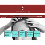 فرشاة شعر كهربائية صغيرة محمولة أيونية مضادة للكهرباء الساكنة تدليك لفروة الرأس مشط علاج تساقط الشعر العناية