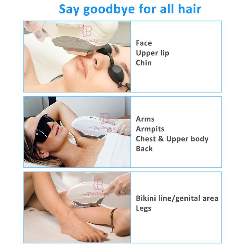 آلة إزالة الشعر بالضوء النبضي المكثف من نوع جديد