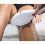 آلة إزالة الشعر بالضوء النبضي المكثف من نوع جديد