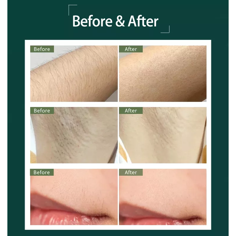 إزالة الشعر المنزلية بالشحن 5th Gear أنبوب الكوارتز مصغرة أجهزة إزالة الشعر الدائم جهاز إزالة الشعر بالليزر باليد