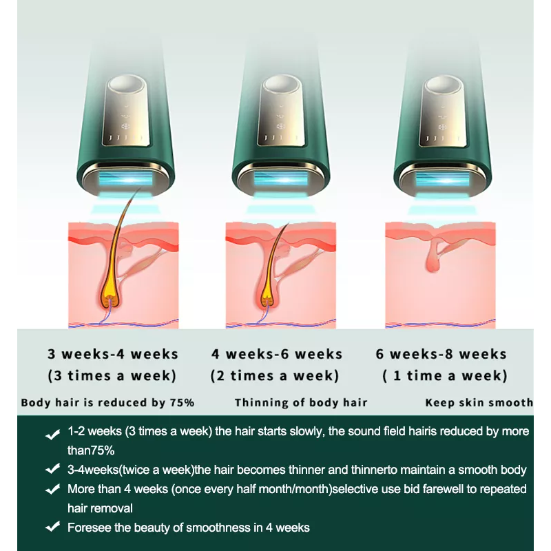 إزالة الشعر المنزلية بالشحن 5th Gear أنبوب الكوارتز مصغرة أجهزة إزالة الشعر الدائم جهاز إزالة الشعر بالليزر باليد
