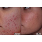 جهاز علاج الوجه بضوء LED ب7 ألوان للعناية بالبشرة والعلاج بالضوء الفوتونى المزدوج PDT