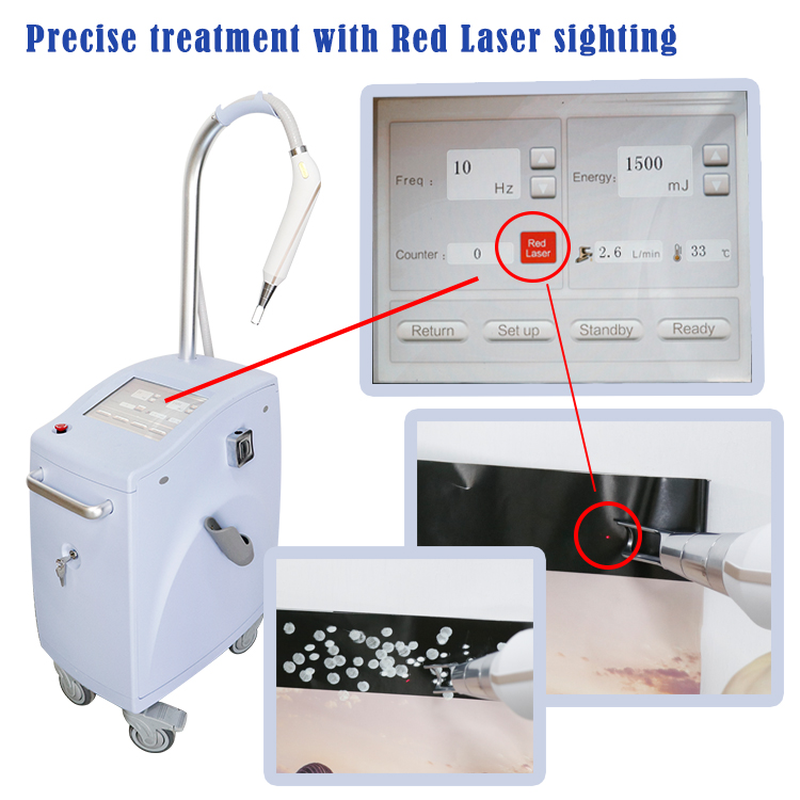 آلة إزالة الوشم بالليزر بيكو Q Switch Nd Yag Laser