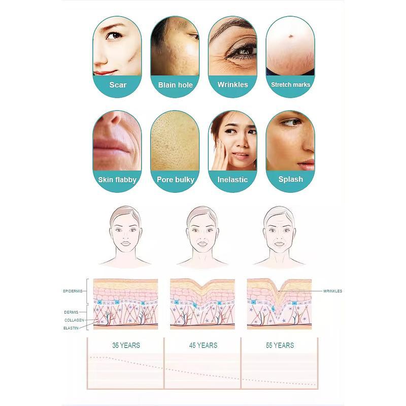 جهاز ميكرونيدلينج احترافي لإزالة الندبات وتشدّيد البشرة مع إبر دقيقة