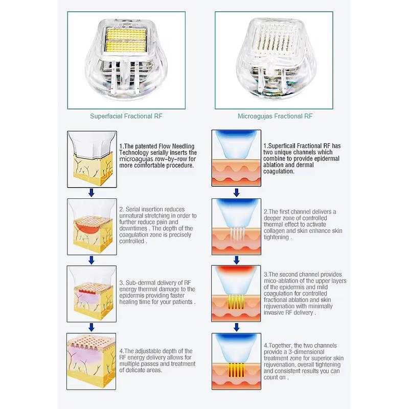 جهاز ميكرونيدلينج احترافي لإزالة الندبات وتشدّيد البشرة مع إبر دقيقة