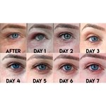 جهاز رفع البلازما جهاز تجميل البلازما المنزلي