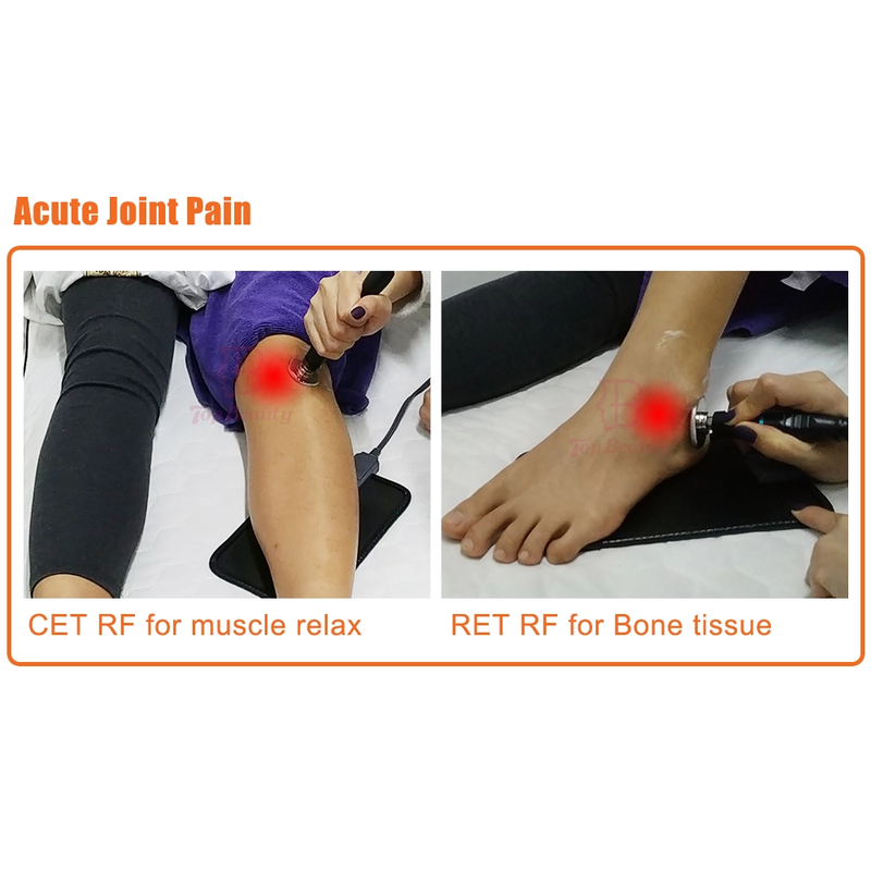 علاج تيكار للعلاج الطبيعي جهاز تيكار أحادي القطب مقاوم وتكثيفي تيكارتيرابيا احترافي