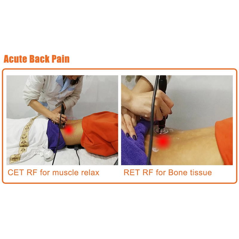 علاج تيكار للعلاج الطبيعي جهاز تيكار أحادي القطب مقاوم وتكثيفي تيكارتيرابيا احترافي