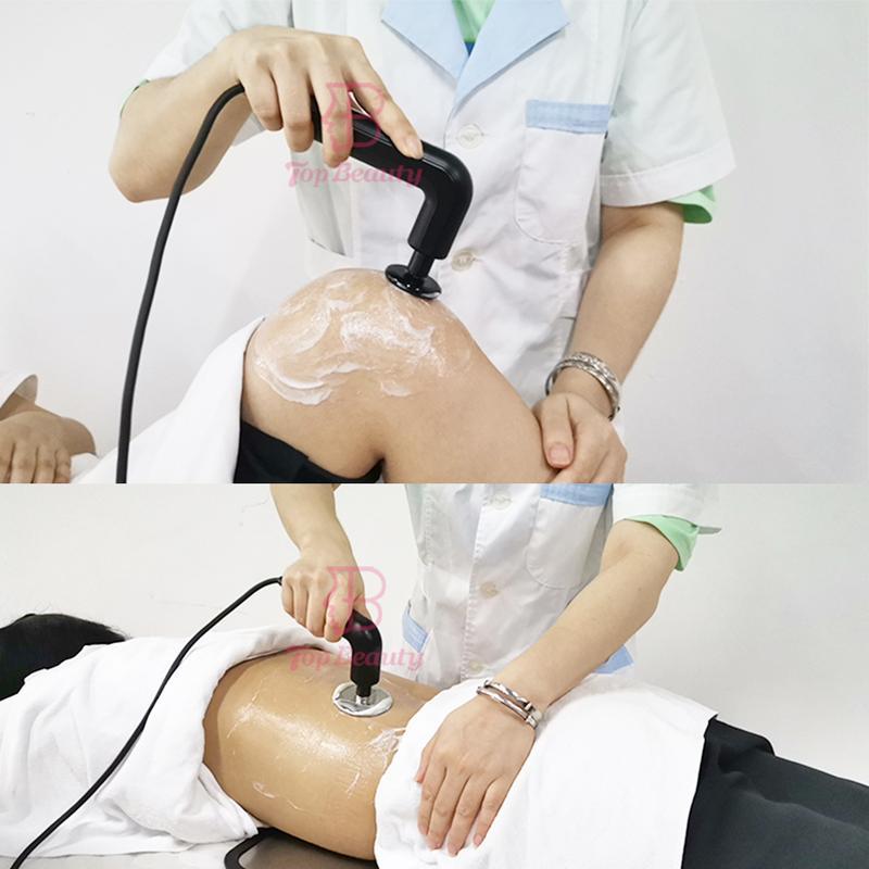 جهاز إنديبا دياثيرمي تيكارتيرابيا الذكي لآلة الترددات الراديوية لحرق الدهون العميقة علاج فيزيائي