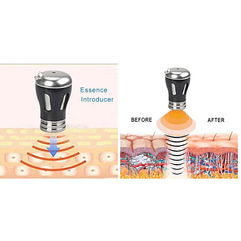 جهاز تجميل RF 2 في 1 جهاز EMS للعناية بالبشرة ومكافحة الشيخوخة جهاز رفع الوجه وإزالة التجاعيد جهاز علاج بالموجات فوق الصوتية EMS