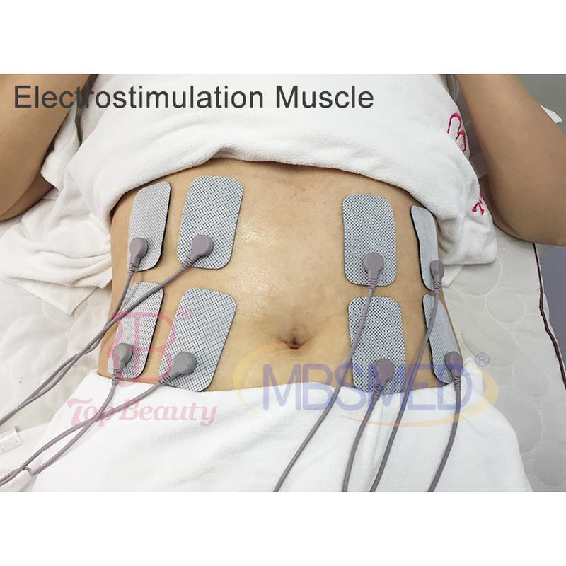 جهاز علاج تيكار إنديبا 448 كيلوهرتز لتخفيف الألم، جهاز تحفيز العضلات بالراديو تردد إنديبا لتنسيق الجسم وآلة العلاج الطبيعي