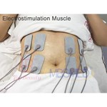 جهاز علاج تيكار إنديبا 448 كيلوهرتز لتخفيف الألم، جهاز تحفيز العضلات بالراديو تردد إنديبا لتنسيق الجسم وآلة العلاج الطبيعي