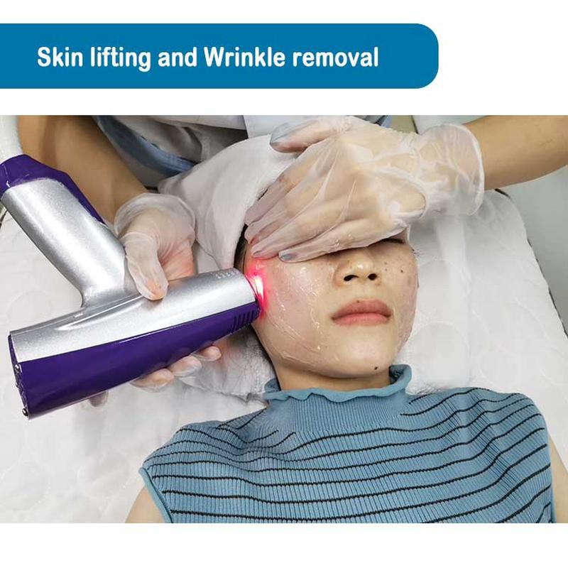 إزالة تجاعيد البشرة بروفايل ميكرونيدلينج ماتريكس للترددات الراديوية (RF)