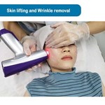 إزالة تجاعيد البشرة بروفايل ميكرونيدلينج ماتريكس للترددات الراديوية (RF)