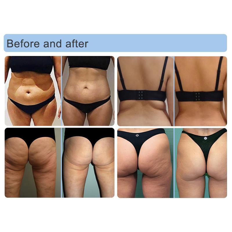 آلة تقليل السيلوليت بالأسطوانة بالأشعة تحت الحمراء ذات التفريغ 5D