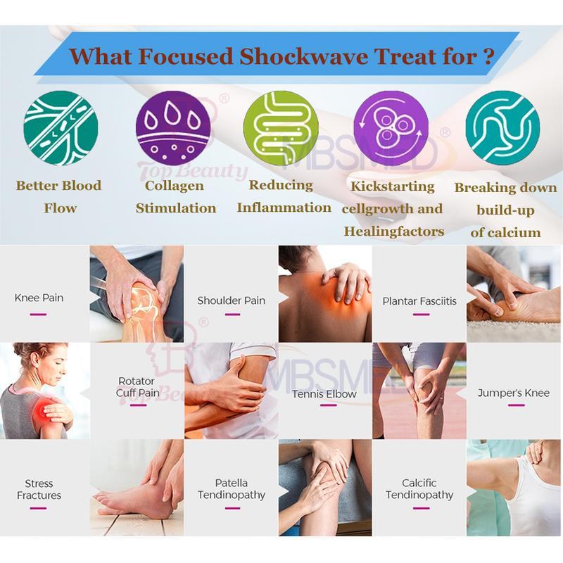 بيع ساخن نظام صدمة موجة eswt ed التركيز، آلة العلاج بالصدمات الموجية المركزة، الصدمة الموجية الفيزيائية