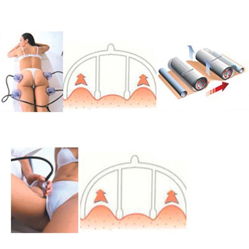 علاج ستارفاك سب2 بالتفريغ الهوائي تدليك العلاج بالكؤوس مدلك الجسم نحت الجسم آلة الكأس التفريغ