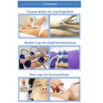 آلة العلاج بالفراغ ستارفاك سب2 ذات الشاشة التي تعمل باللمس لعلاج الكوب بالفراغ والتخسيس