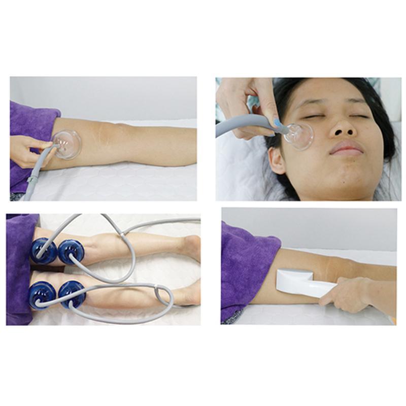 آلة العلاج بالفراغ ستارفاك سب2 ذات الشاشة التي تعمل باللمس لعلاج الكوب بالفراغ والتخسيس