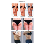 آلة تنحيف الجسم المحمولة EMS لتحفيز العضلات بقوة احترافية